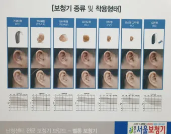 보청기 선택 귀걸이형 귓속형 배터리 교체 유지관리_19
