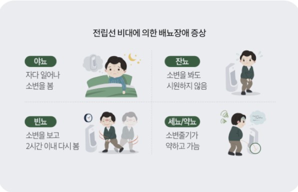 카리토포텐 가격 효능