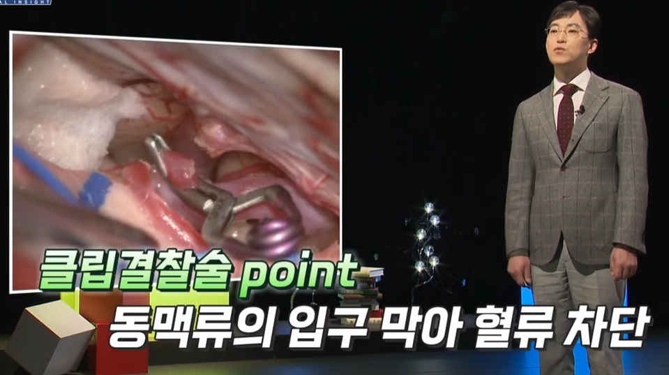 클립결찰술