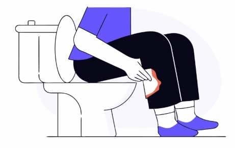 치질 원인과 의심증상