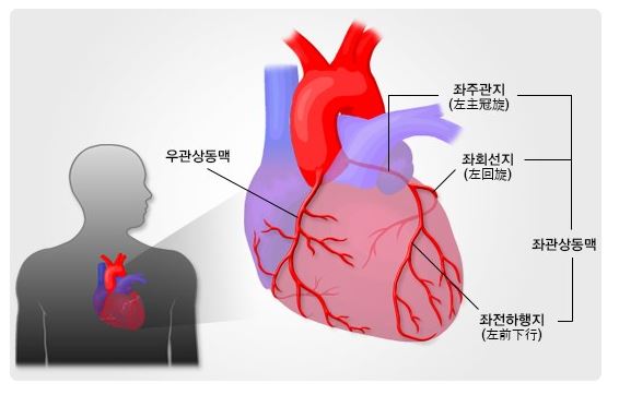 관상동맥