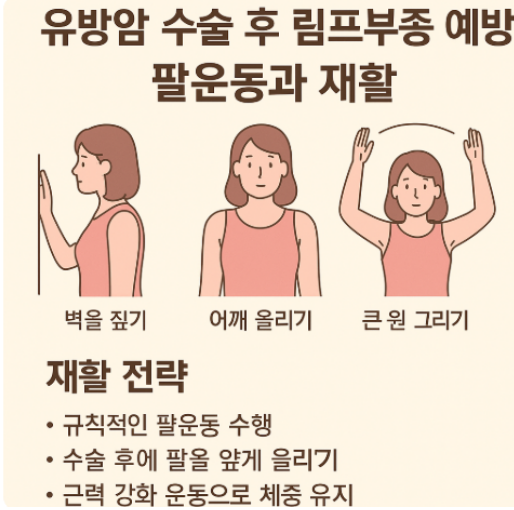 유방암 수술 후 재활운동