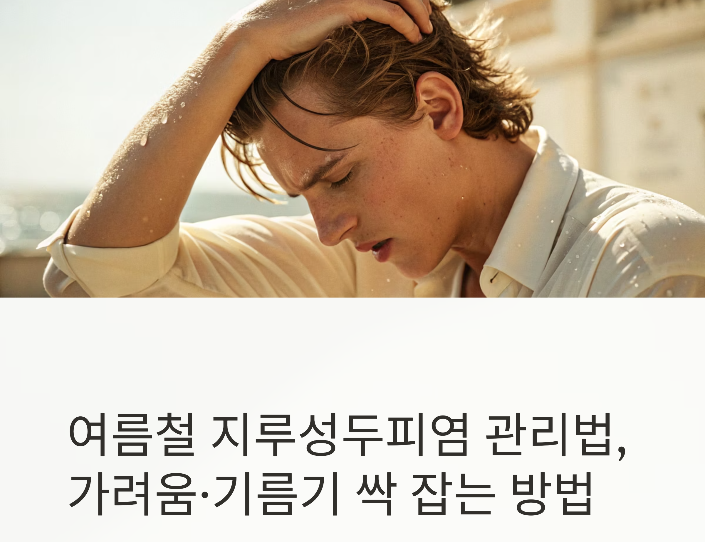 여름철 지루성 두피염 관리법 관련 사진