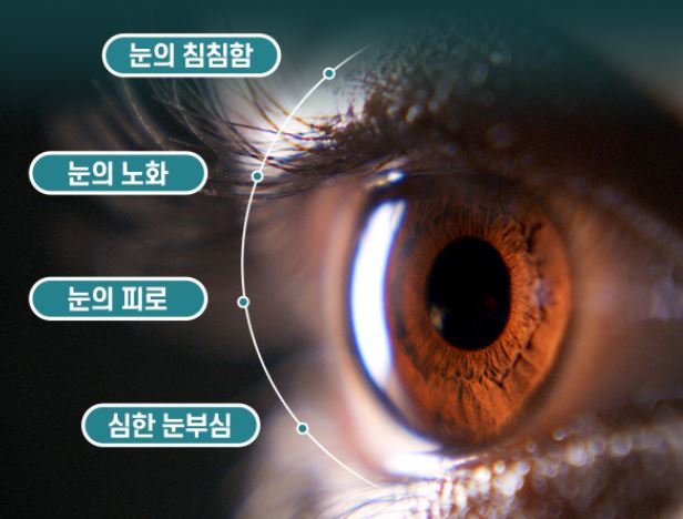 케이뉴트라 루테인 아이케어