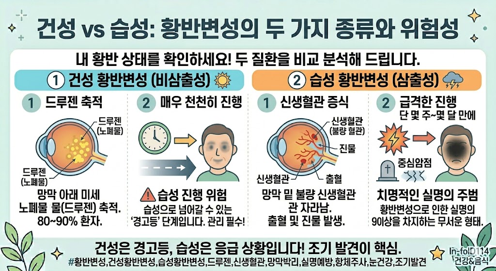 황반변성 치료법