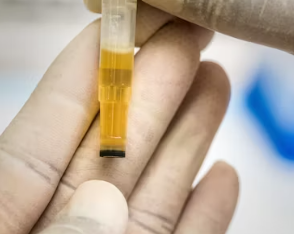 요실금 치료방법 진단 기준 합병증