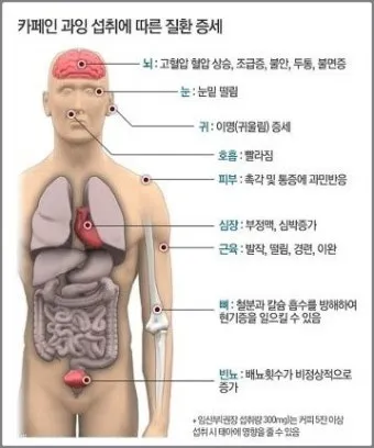 카페인 부작용 중독 증상 두통 원인 정리 정보_4