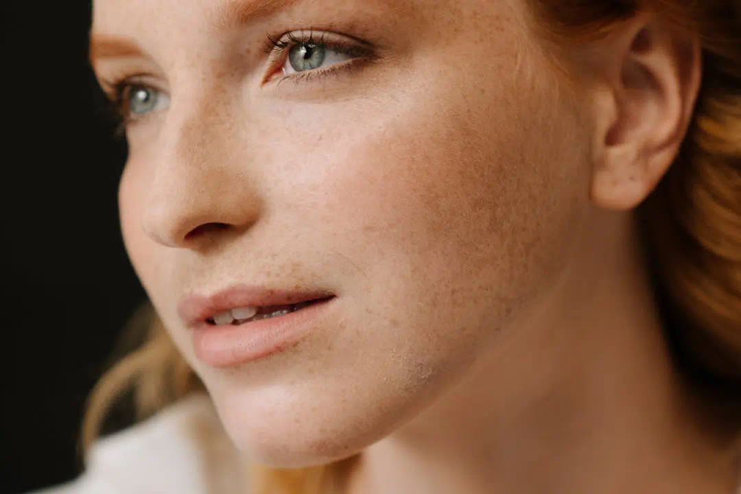 기미 있는 여성의 사진3