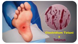 파상품-감염-테타누스균