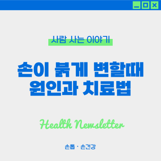 손이 붉게 변할 때 원인과 치료법: 혈액순환 장애, 알레르기, 전신건강