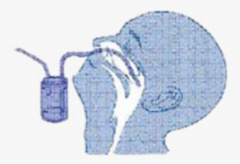 마이코플라즈마 폐렴 원인, 증상, 항생제 치료