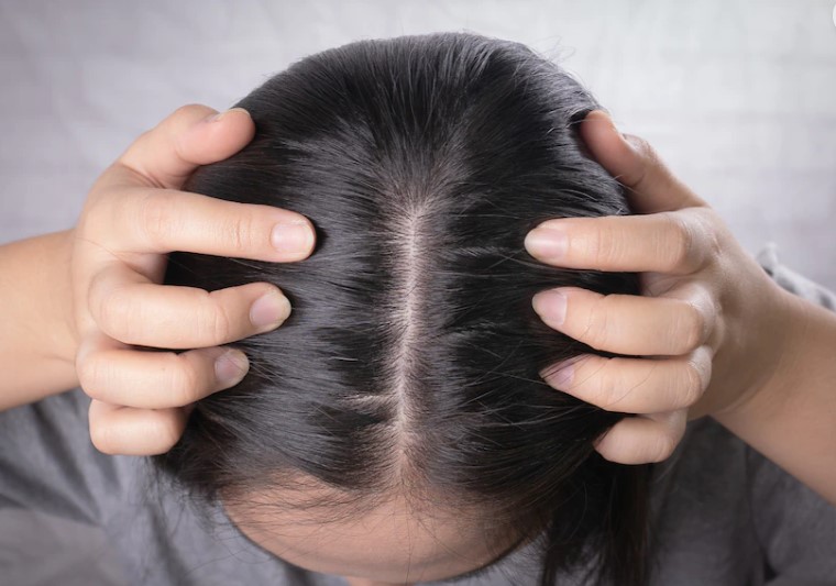 천연염색제 헤나부작용
헤나부작용 치료방법
헤나염색 부작용