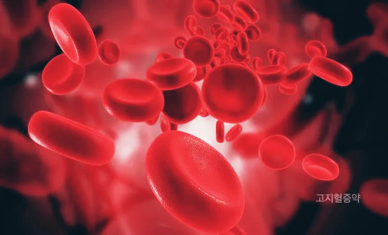 심혈관 질환 고지혈증