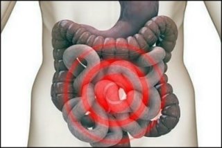 대표적인 원인균 종류