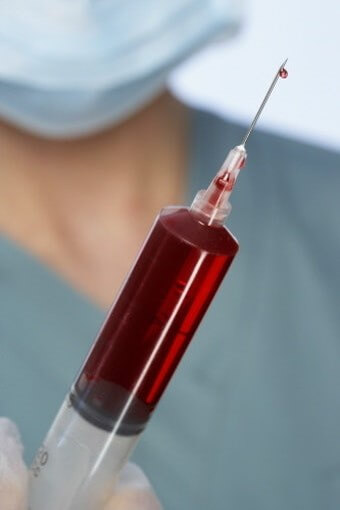 주사기로-채혈한-피를-한방울-뽐어보는-의사