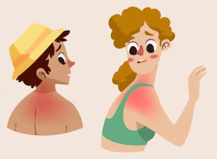 땀띠-자연-치유-치료-법-2