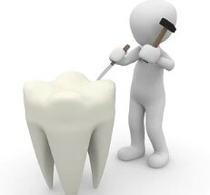 치아가 빠졌을때