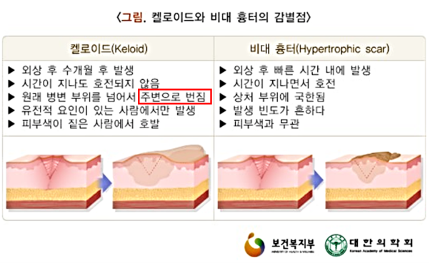 출처-국가정보포털 의학정보