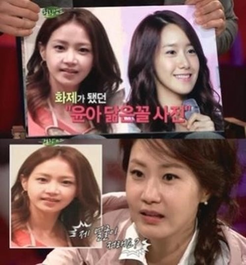 신은경 성형전후