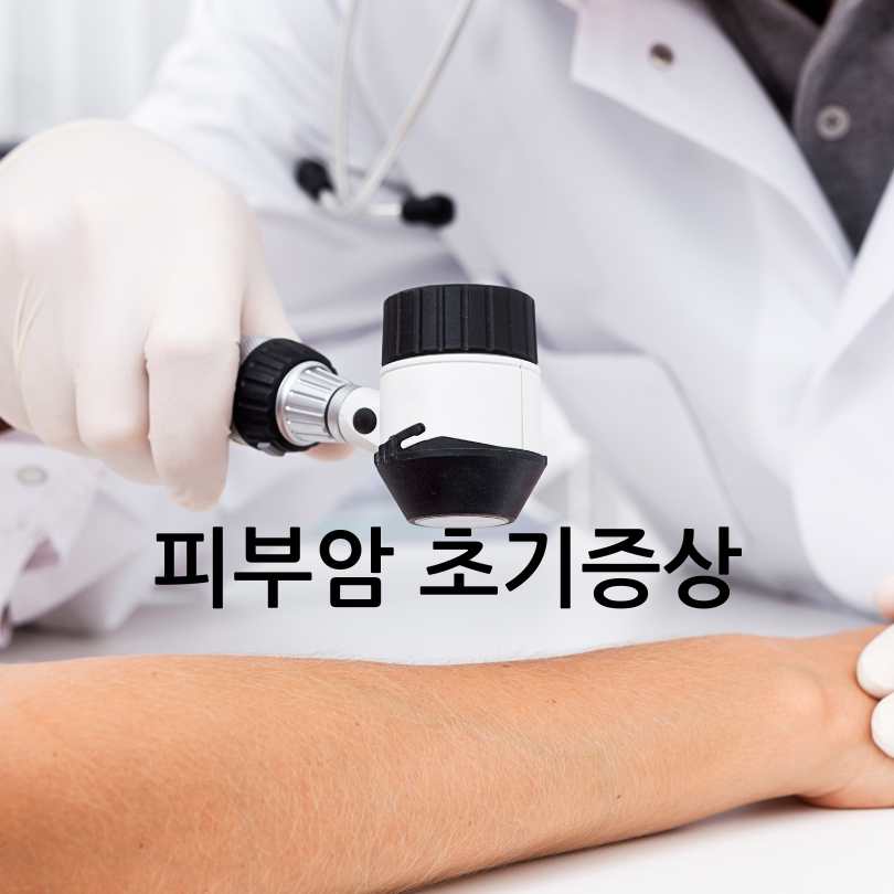 피부암 자가진단법, 피부암 점모양과 초기증상