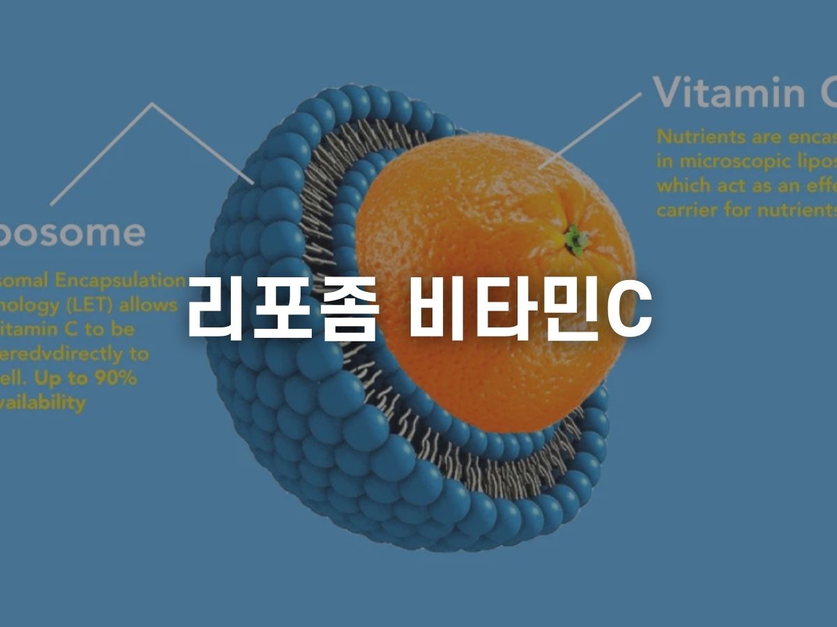 리포좀 비타민C 메가도스 차이