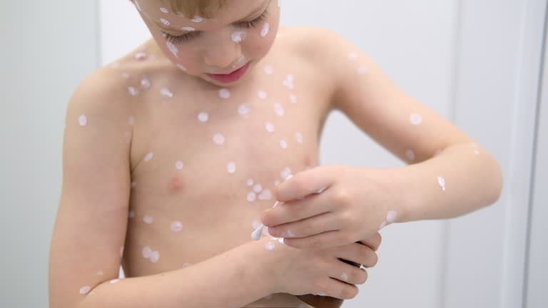 패인 수두 자국, 어떻게 없앨까? 효과적인 방법과 병원 선택 꿀팁