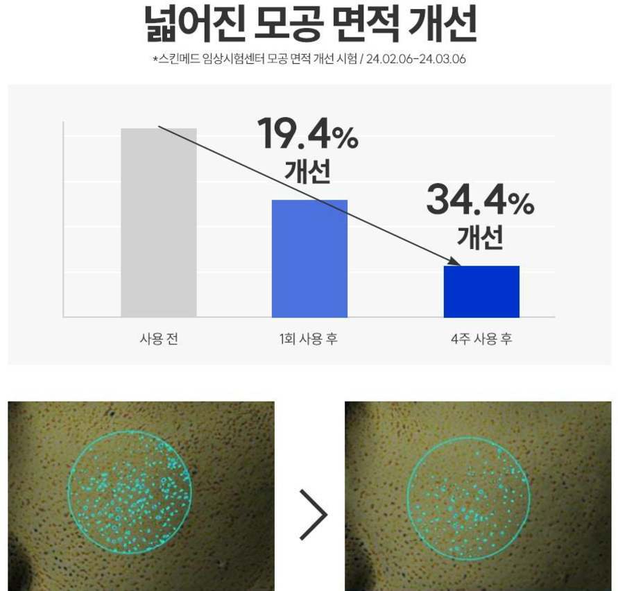 올리브영 12월 스킨패드 추천