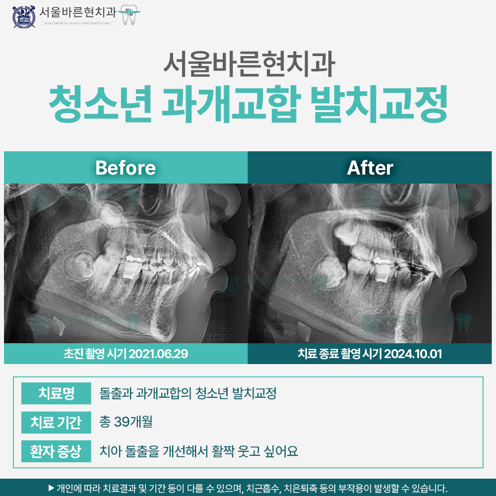 부산교정치과