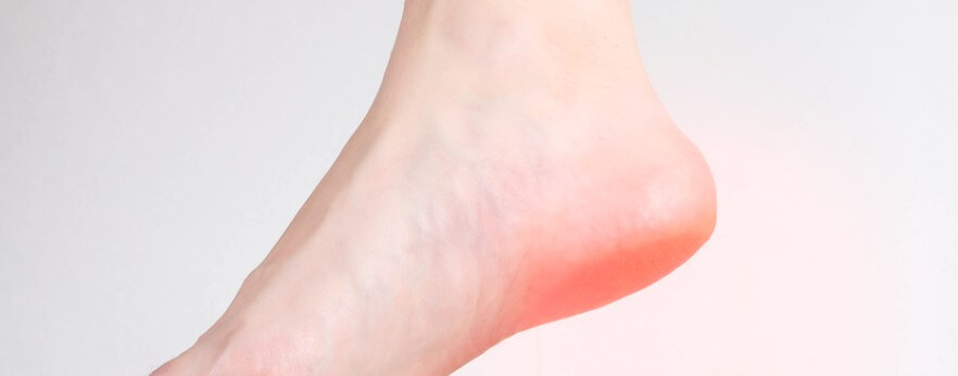 발 뒤꿈치 통증