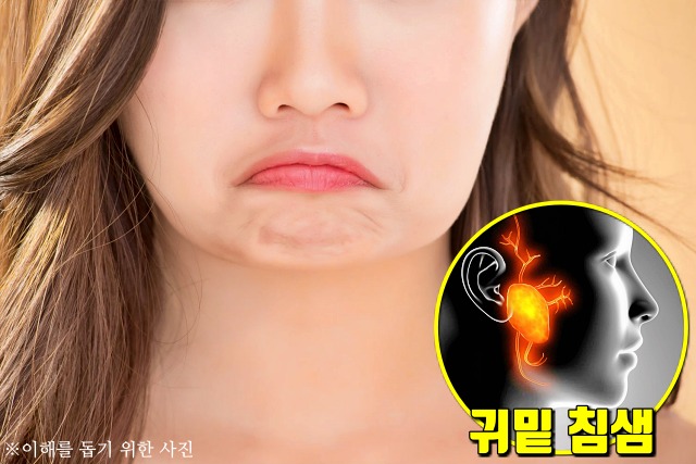 다이어트,턱살,턱밑살,이중턱,사각턱,턱선,턱밑이 붓는 이유,침샘 비대증,건강 팁줌 매일꿀정보