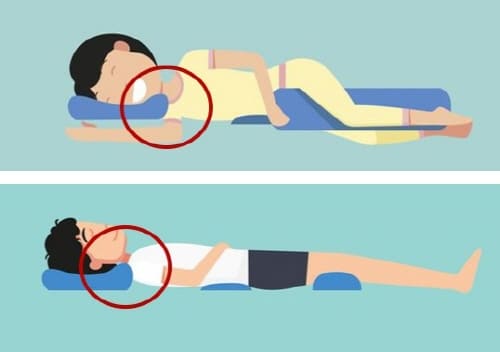 목이더높은베개를사용