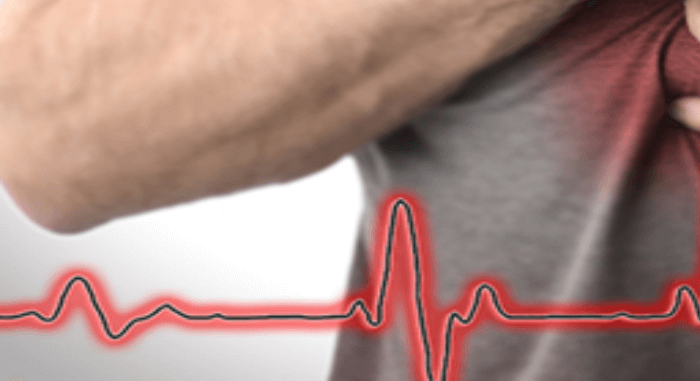 고지혈증증상흉통