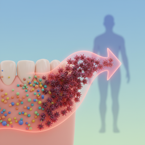 잇몸 염증과 구강 미생물: 은밀한 전신 질환의 시작