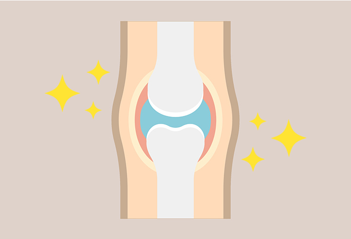 건강한-관절의-모습