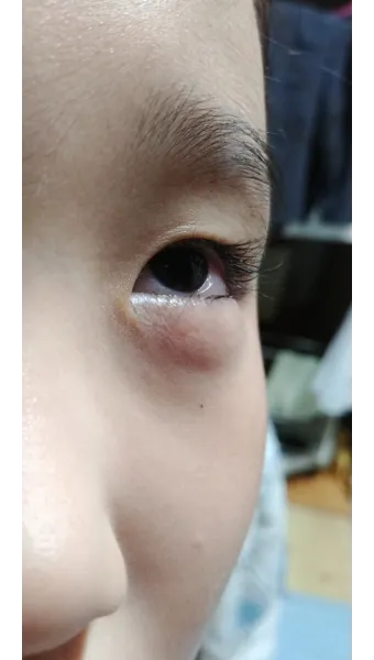 고양이 털 알레르기 완화 방법과 생활 관리 팁_21