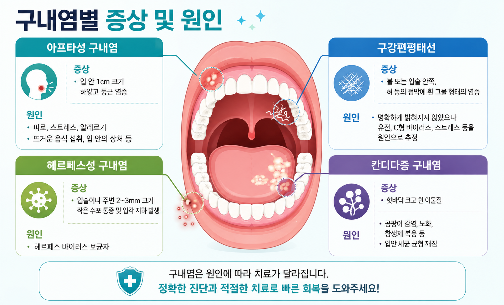 구내염별 증상 및 원인