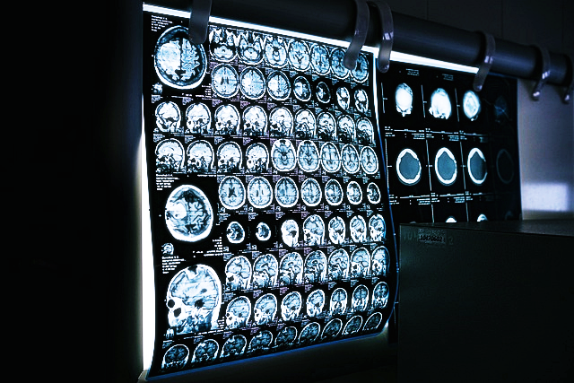 채용 건강 검진 주요 항목1