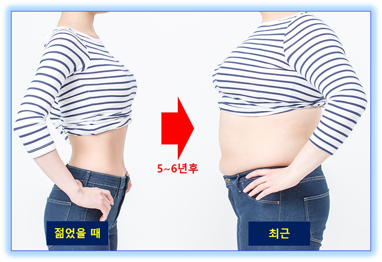 중년기건강관리