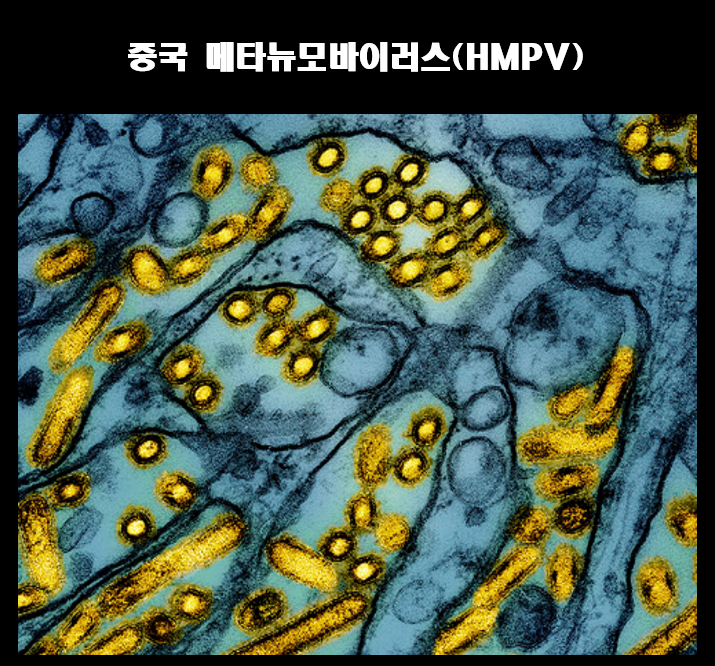 중국-메타뉴모바이러스-HMPV