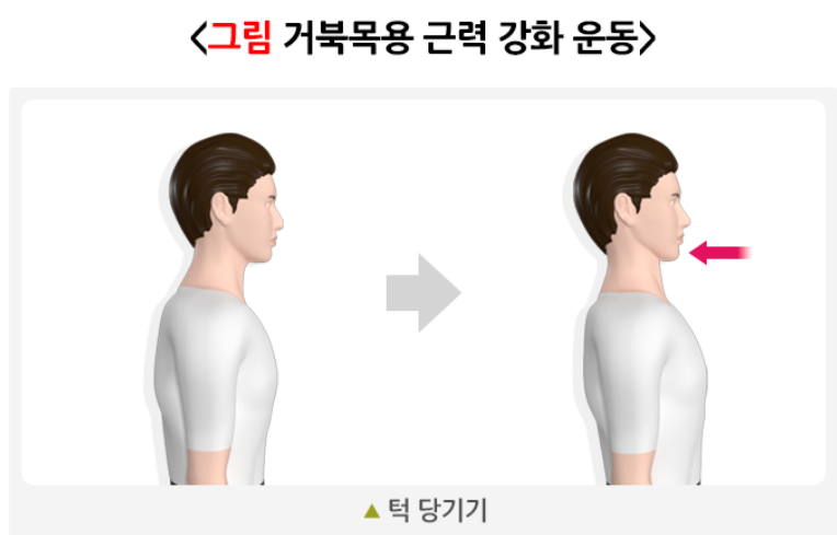 거북목 증후군 스트레칭 방법 근력강화운동1