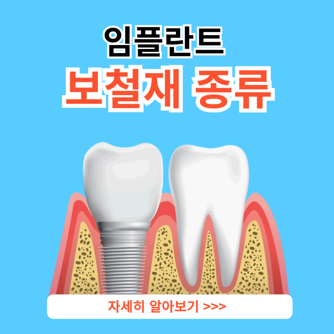 임플란트 보철재 비교 총정리 (Gold PFM Zirconia )