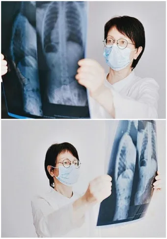 늑막에 물이 차는 이유와 치료 방법_21