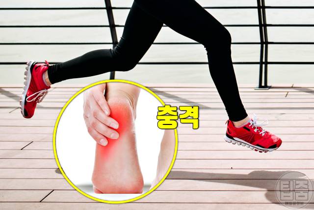 발뒤꿈치 찌릿 따끔 발바닥 전기 통증 근육통
