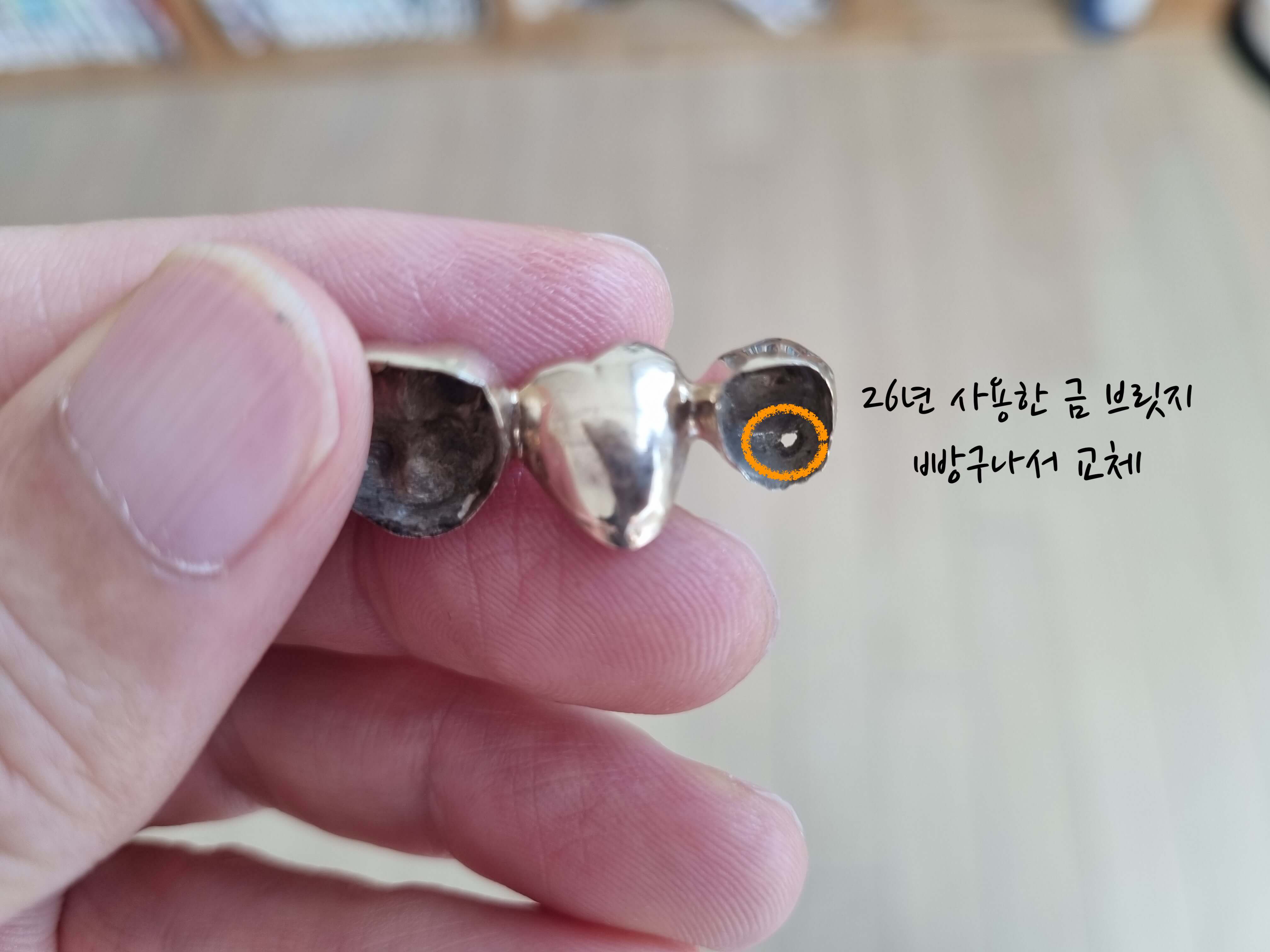 금 브릿지