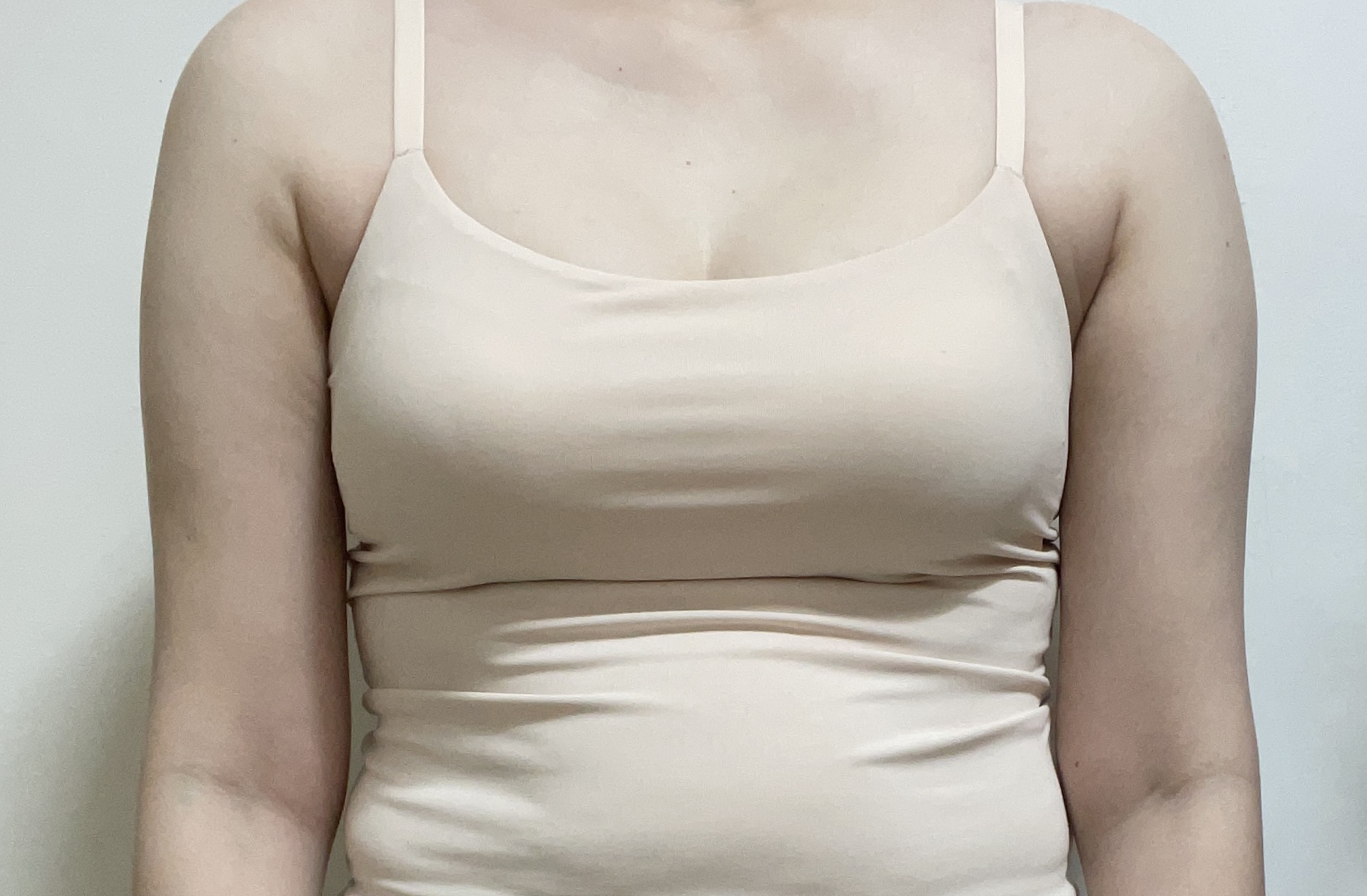 수술하기전 모습.