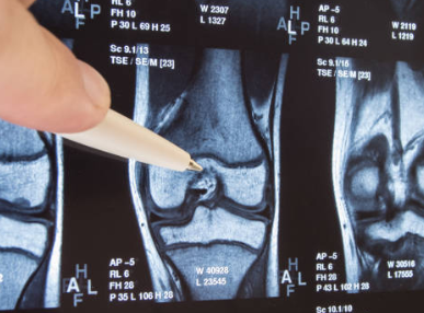 관절염의 진단 과정