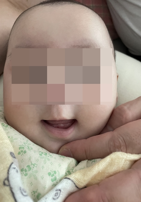 치아가 나기 시작한 아기의 모습
