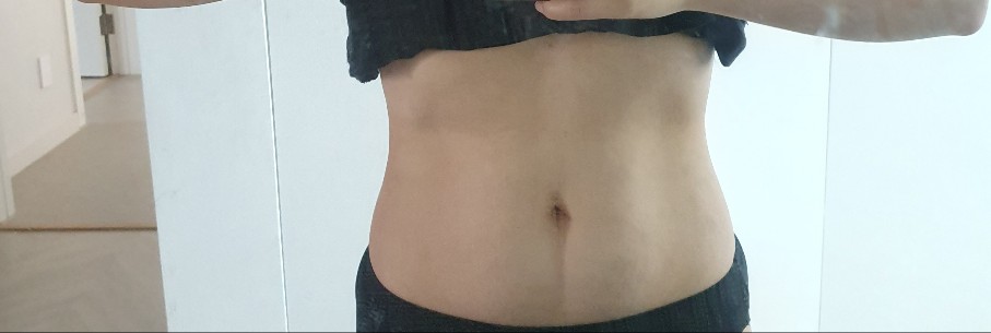 브로멜라인 복용 후기