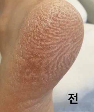 셀로몬-사용전