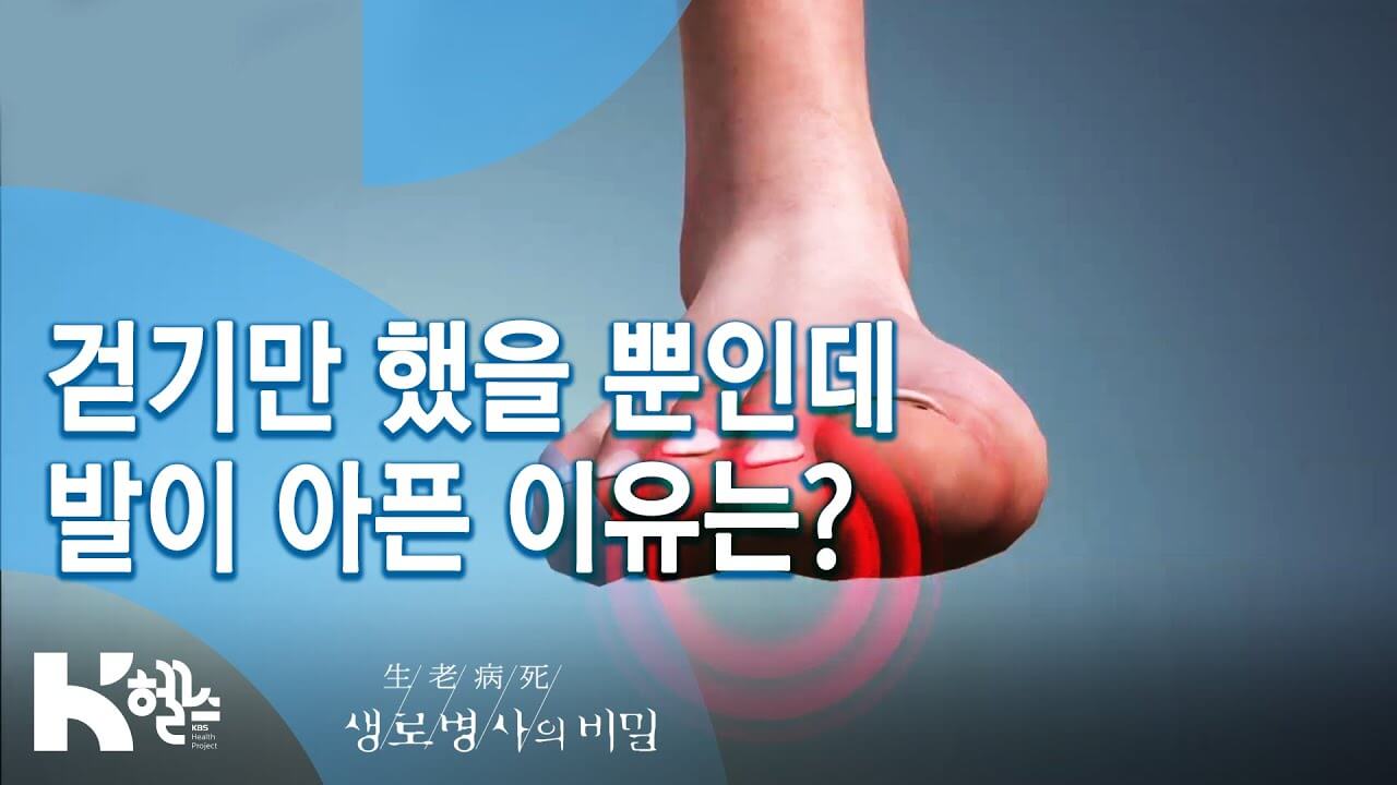 KBS 생로병사의 비밀 맨발 걷기 효능과 부작용